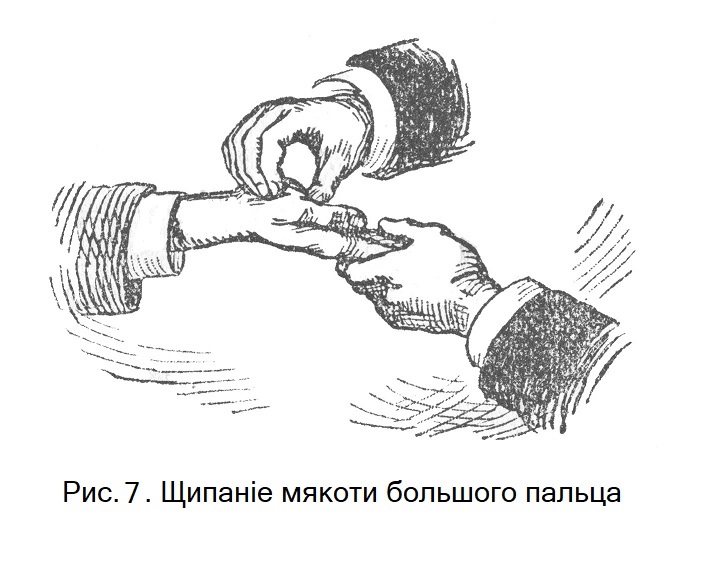 Щипаніе мякоти большого пальца